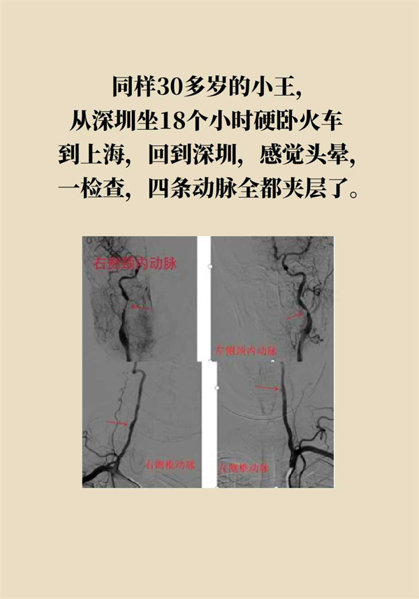 這個(gè)動(dòng)作讓多名年輕人中風(fēng)了，一定要重視！